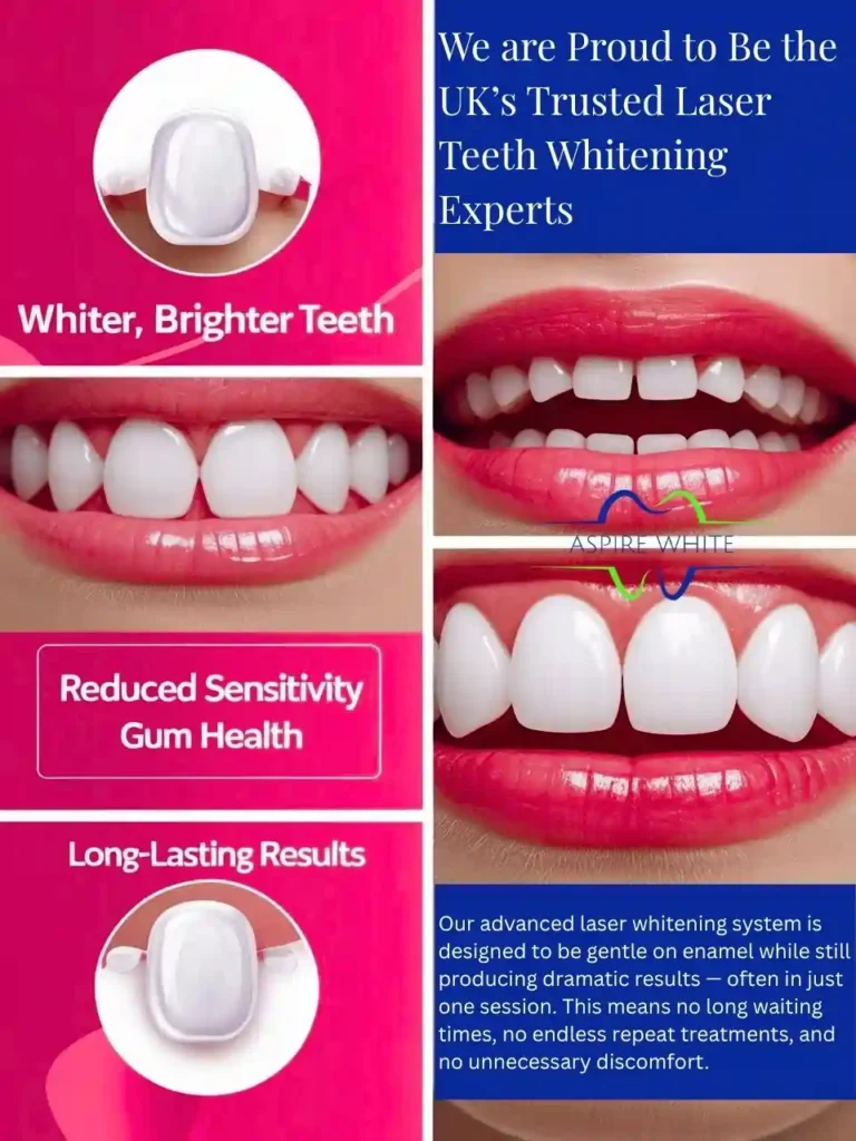 We are Proud to Be the UK’s Trusted Laser Teeth Whitening Experts Watford