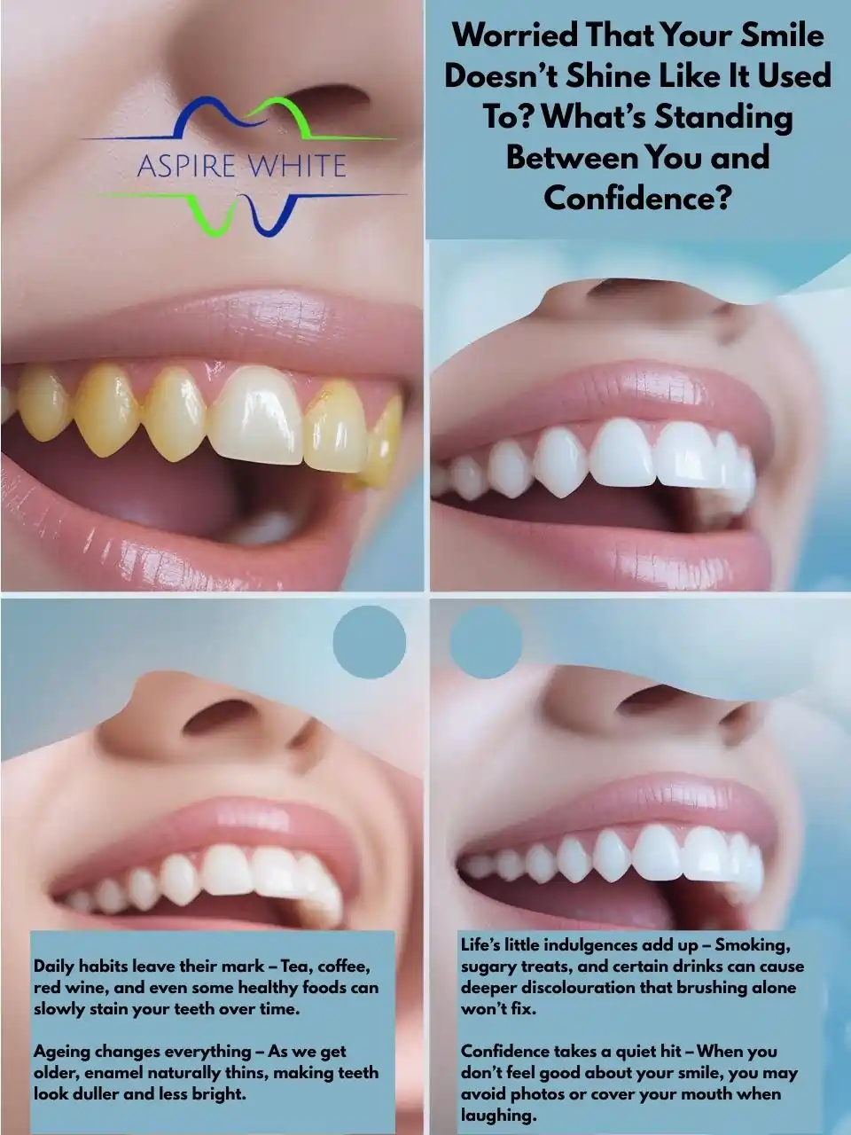 Worried That Your Smile Doesn’t Shine Like It Used To What’s Standing Between You and Confidence Watford